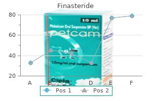 discount finasteride 5 mg on-line