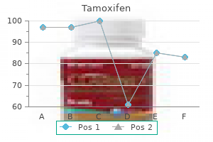 discount 20mg tamoxifen mastercard