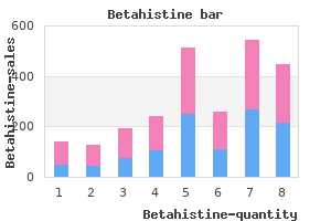 betahistine 16mg generic