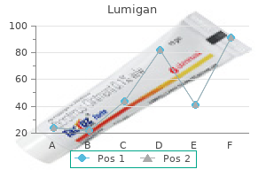buy lumigan line