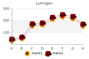 best purchase lumigan