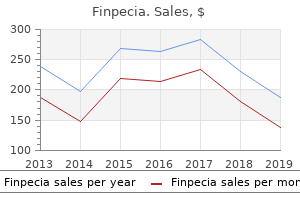 purchase 1mg finpecia visa