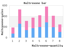 cheap generic naltrexone uk