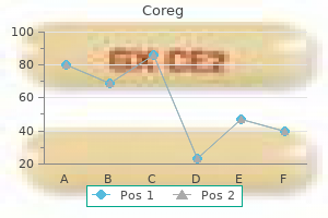 buy discount coreg on line
