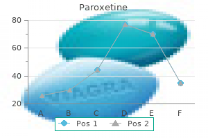 order paroxetine master card